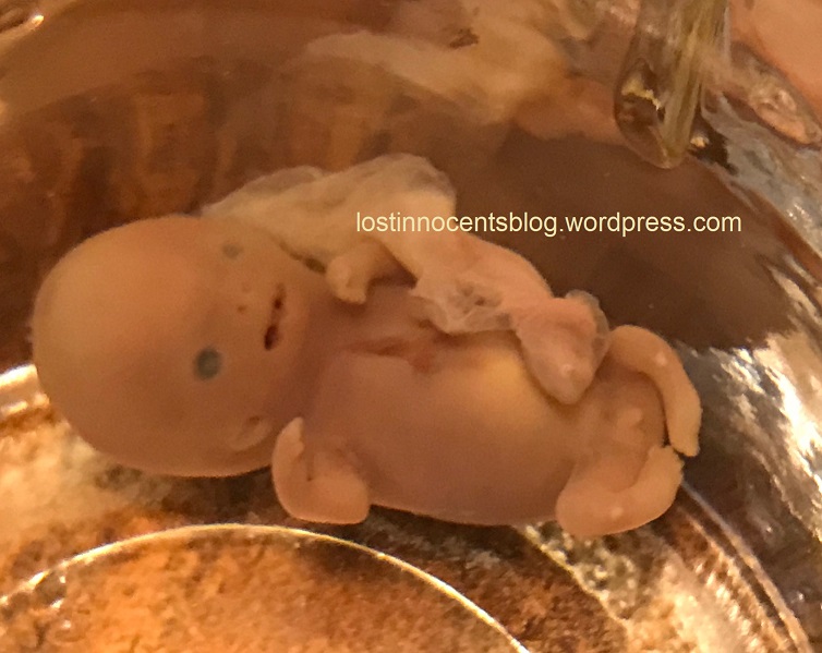 1 myra-peanut 9w5d - wm