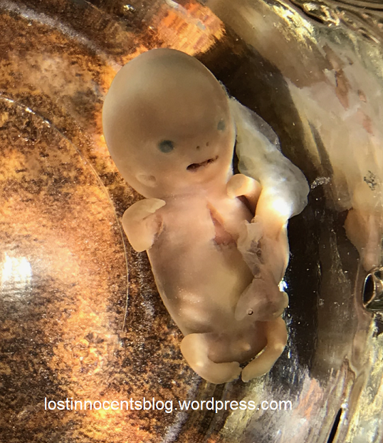 2 myra-peanut 9w5d - wm