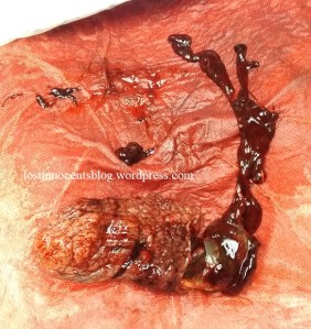 Quinn Zoe 13w6d 2 - WM